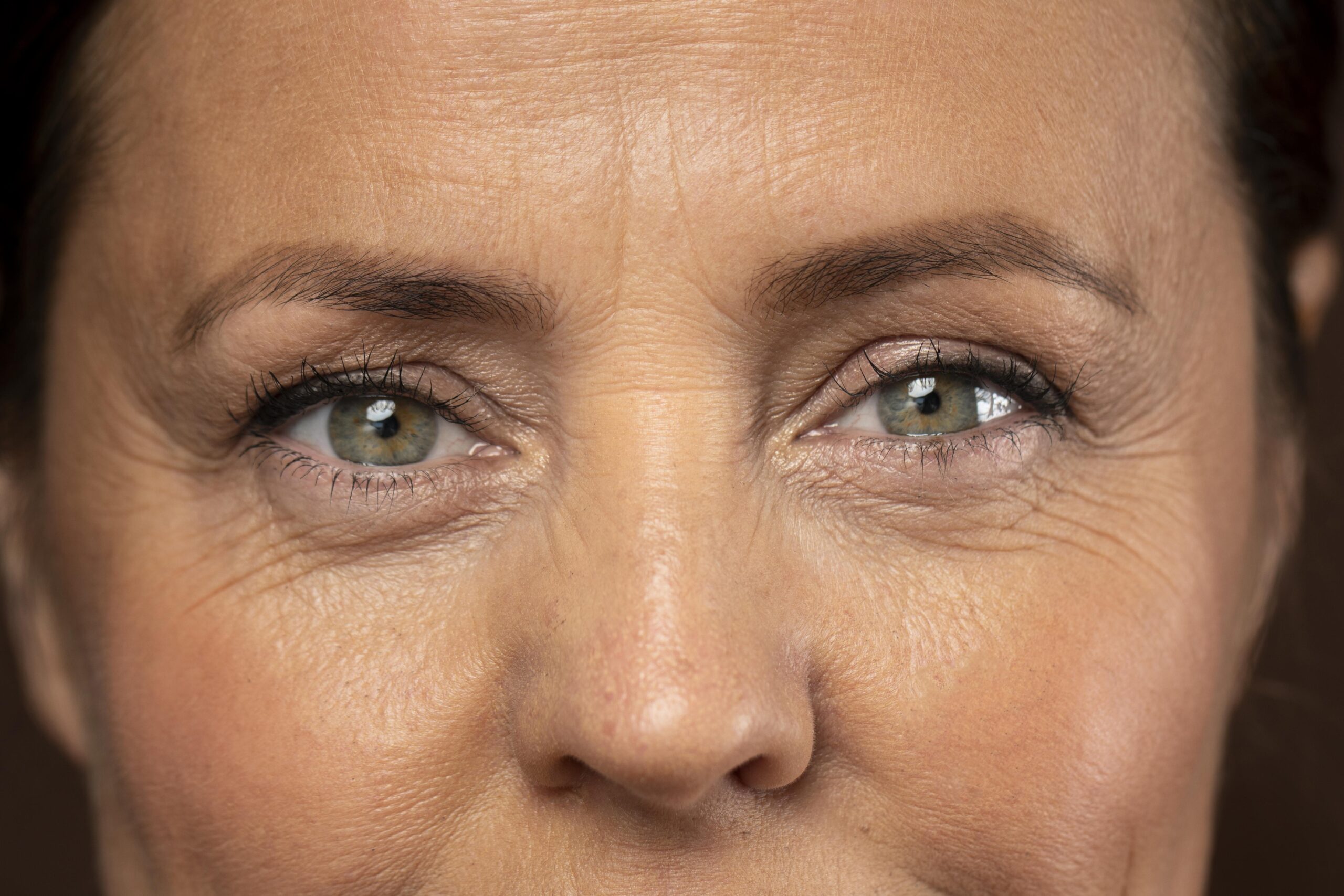 Blefaroplastia Superior ou Inferior: Qual Procedimento Revitaliza Melhor Seu Olhar?